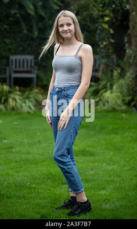 Emily Eccles, an ihrem Haus in Yorkshire, nachdem Sie erlitt eine der schlimmsten Gesichtsverletzungen ärzte gesehen haben, vor einem Krieg, in einem Reiten Unfall. Stockfoto