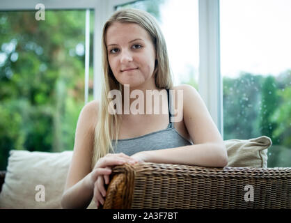 Emily Eccles, an ihrem Haus in Yorkshire, nachdem Sie erlitt eine der schlimmsten Gesichtsverletzungen ärzte gesehen haben, vor einem Krieg, in einem Reiten Unfall. Stockfoto