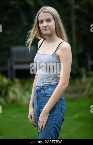 Emily Eccles, an ihrem Haus in Yorkshire, nachdem Sie erlitt eine der schlimmsten Gesichtsverletzungen ärzte gesehen haben, vor einem Krieg, in einem Reiten Unfall. Stockfoto