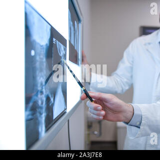 Ärzte Prüfung X-Ray Prüfungen Stockfoto