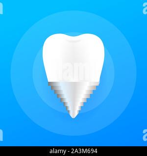 Krone Implantat Zahn Symbol. Menschliche Zahnimplantat. Vector lieferbar Abbildung. Stock Vektor