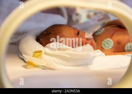 Frühgeburt Station in einem Krankenhaus, Abteilung für Neonatologie Frühgeborene in einem Inkubator, Stockfoto