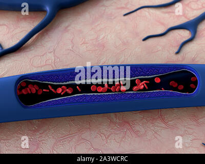 Arterie mit einem abgetrennten Bereichs, hochwertige Rendering mit original Texturen und Global Illumination gezeigt, Stockfoto