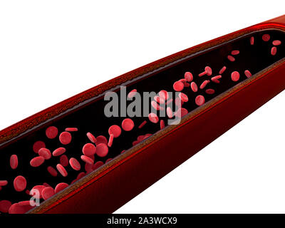 Blutgefäße, Arterien mit einem abgetrennten Bereichs, Kontraktion der Blutgefäße, Adrenalin in tne Blutgefäße dargestellt Stockfoto