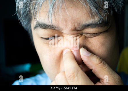 Asiaten sind die Pickel und Mitesser und Akne Narben auf seiner Nase. Stockfoto