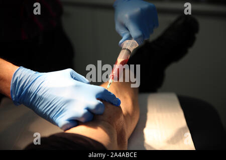 Bursitis Aspiration Stockfoto