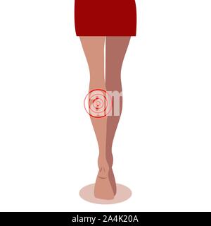 Shin Schmerzen, Krankheiten der weiblichen Beinen, Pflege für Körper, womans Gesundheit, Krampfadern. Vector Illustration Stock Vektor