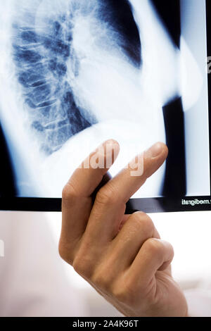 Männlicher Arzt eamining x-ray - Lungenkrebs Stockfoto