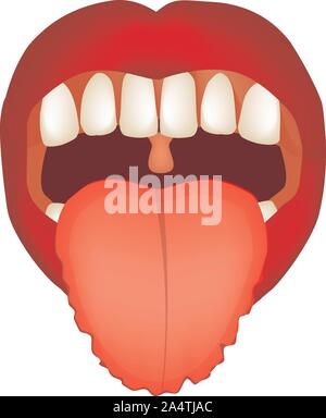 Zähne Abdrücke auf der Zunge. Definition einer Krankheit nach der menschlichen Zunge. Diagnose durch die Zunge. Zunge Vector Illustration auf isolierte Stock Vektor