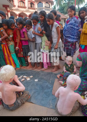 Albino Kinder, Mitglieder des Erweiterten Indischen albino Familie, um Spenden in Udipi, Karnataka, Indien, starrte durch eine Schar von Kindern Stockfoto