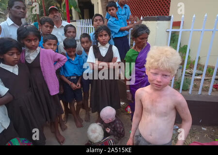 Albino Jungen, Mitglieder des Erweiterten Indischen albino Familie um Spenden in Udipi, Karnataka, Indien, starrte durch eine Schar von Kindern Stockfoto