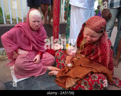 Die Mitglieder des Erweiterten Indischen albino Familie, zwei Frauen und ein Baby, um Spenden in Udipi, Karnataka, Indien, von neugierigen Einheimischen umgeben Stockfoto