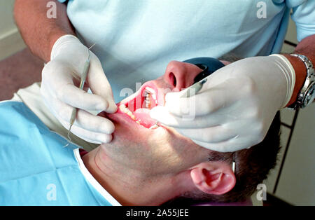 Ein Mann seine Zähne geprüft und gereinigt am Zahnarzt Stockfoto