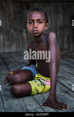 (191020) - GUADALCANAL, Oktober 20, 2019 (Xinhua) - ein Kind liegt in Guadalcanal, Salomonen, Okt. 10, 2019. (Foto von Zhu Hongye/Xinhua) Stockfoto