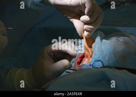 Die Cochlear Implantation Chirurgie Operation in der Medizinischen Klinik in Astrachan, Russland Stockfoto