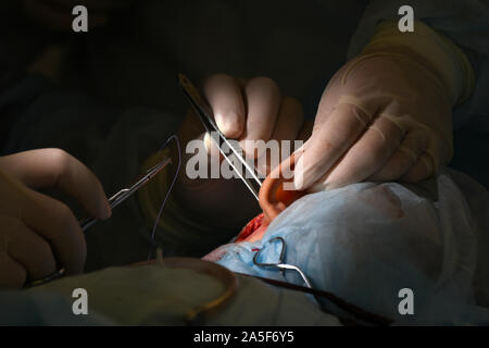 Die Cochlear Implantation Chirurgie Operation in der Medizinischen Klinik in Astrachan, Russland Stockfoto