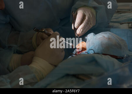 Die Cochlear Implantation Chirurgie Operation in der Medizinischen Klinik in Astrachan, Russland Stockfoto