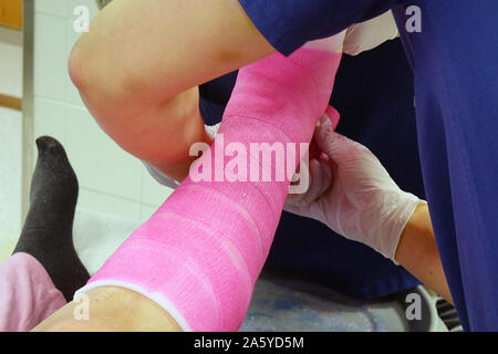 Orthopädische werfen. Arzt verputzen gebrochenen Knöchel von Patienten mit rosa Fiberglas oberen Schicht. Stockfoto