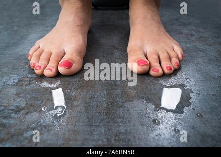 Frau mit schwitzenden Füßen stehend auf dem Boden Stockfoto