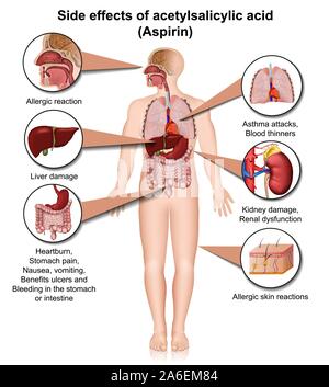 Aspirin Körper Effekte 3 d medical Vektor Infografik auf weißem Hintergrund Stock Vektor