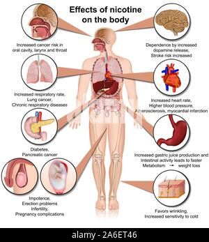 Auswirkungen von Nikotin auf den Körper medizinische Vektor-illustration Infografik auf weißem Hintergrund Stock Vektor