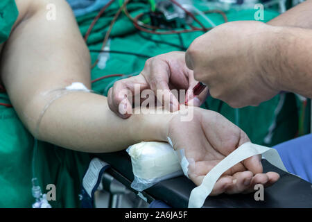 Arzt die Blutprobe von Patienten im Operationssaal. Blut Zeichnung Probe für Blut die Gesundheit Test. Stockfoto