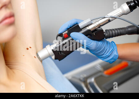 Kosmetologie Service. Junge Frau Schönheitsklinik liegt beim Arzt Holding laser Entfernen der Haare auf achselhöhle close-up Stockfoto