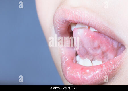 Baby Zahn, close-up der Zahn, der fällt Makroaufnahme. Stockfoto