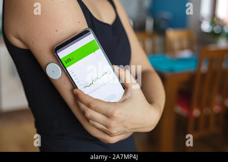 Frau Kontrolle der Blutzuckerspiegel mit einer modernen Technologie remote Sensor und Mobiltelefon, ohne Blut. Diabetes Behandlung. Stockfoto