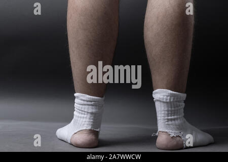 Rückseite des stehenden Füße mit weißen Socken und ein großes Loch vor grauem Hintergrund Stockfoto