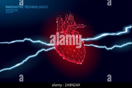 3D Medizin Herzinfarkt Warnung. Menschliche Gesundheit Diagnostik Gefäßorgansystem schmerzhafte Krankheit. Kardiologie Herzschutz Konzept. Niedriger Poly-Vektor Stock Vektor