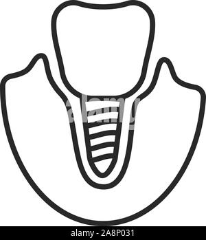 Dünne Linie Symbol des Zahnimplantats auf Weiß isoliert Stock Vektor