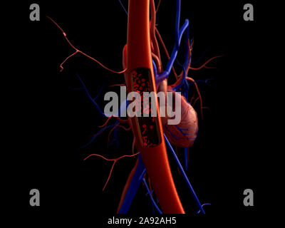Blutgefäße, Arterien mit einem abgetrennten Bereichs, hochwertige Rendering mit original Texturen und Global Illumination gezeigt Stockfoto