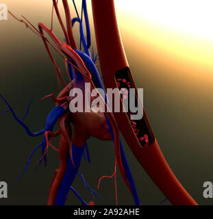 Blutgefäße, Arterien mit einem abgetrennten Bereichs, hochwertige Rendering mit original Texturen und Global Illumination gezeigt Stockfoto