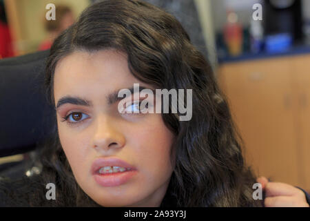 Mädchen mit Tuberous Sklerose lernen in der Schule Stockfoto