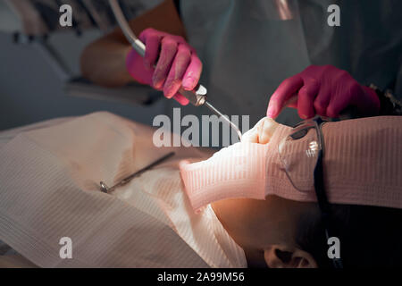 Zahnarzt in Gummihandschuhe, Verfahren mit Dental curing UV-Licht. Patienten besuchen Zahnklinik, sitzen in der zahnmedizinischen Stuhl mit Eröffnung Mund. Arzt ausfüllen Zähne. Stockfoto