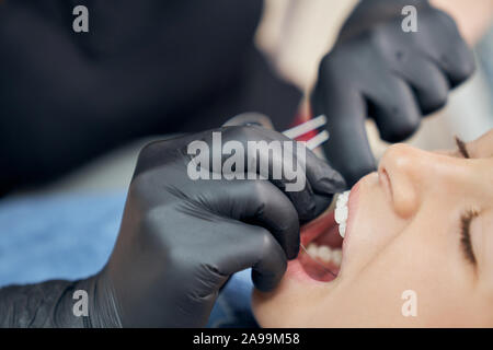 Nahaufnahme des Gesichts des Patienten öffnen mit Mund und Händen von Zahnarzt in schwarzem Gummi Handschuhe. Arzt mit metallischen Klammern für die Ausrichtung der Zähne des Mädchens. Konzept der Gesundheit und Schönheit. Stockfoto