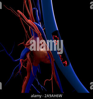 Blutgefäße, Arterien mit einem abgetrennten Bereichs, hochwertige Rendering mit original Texturen und Global Illumination gezeigt, Stockfoto