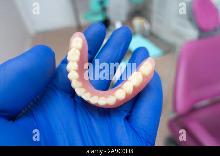 Herausnehmbarer Zahnersatz in den Händen eines Arztes in blau Handschuhe Stockfoto