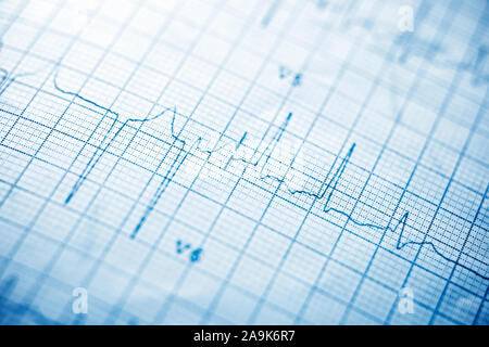 Nahaufnahme von einem Elektrokardiogramm in Papierform. Stockfoto