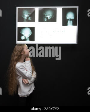 Aufmerksamer Detektiv Mädchen an der Platine mit physischen Evi suchen Stockfoto