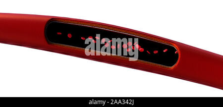 Blutgefäße, Arterien mit einem abgetrennten Bereichs, hochwertige Rendering mit original Texturen und Global Illumination gezeigt, Stockfoto