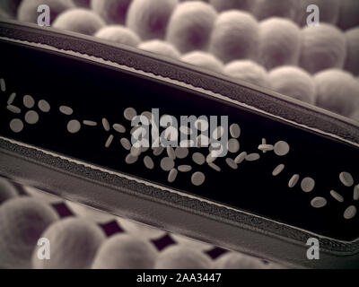 Arterie mit einem abgetrennten Bereichs, hochwertige Rendering mit original Texturen und Global Illumination, Kontraktion der Blutgefäße dargestellt Stockfoto