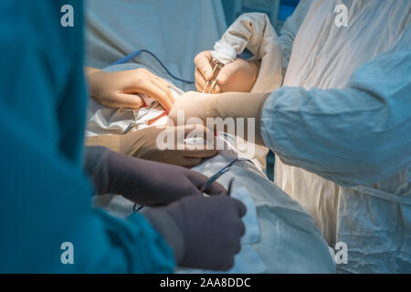 Team von Chirurgen während einer Operation. Sterile Op. Niere Chirurgie in einem kleinen Patienten. Chirurgische Verfahren Diagnose Stockfoto