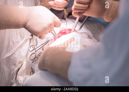 Team von Chirurgen während einer Operation. Sterile Op. Niere Chirurgie in einem kleinen Patienten. Chirurgische Verfahren Diagnose Stockfoto