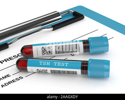 3D-Render von TSH Test Blutröhrchen liegen auf Zwischenablage auf weißem Hintergrund Stockfoto