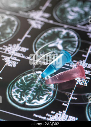 Klinische Proben vom Forschungsprojekt in Durchstechflaschen mit Gehirn Scannen von Bildern, der Erforschung von Alzheimer und Demenz medizinische Bedingungen enthalten. Stockfoto