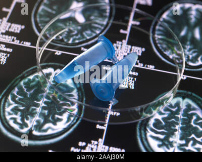 Klinische Proben vom Forschungsprojekt in Durchstechflaschen mit Gehirn Scannen von Bildern, der Erforschung von Alzheimer und Demenz medizinische Bedingungen enthalten. Stockfoto