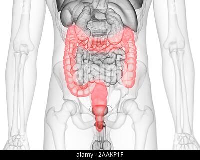 Dickdarm, computer Abbildung. Stockfoto