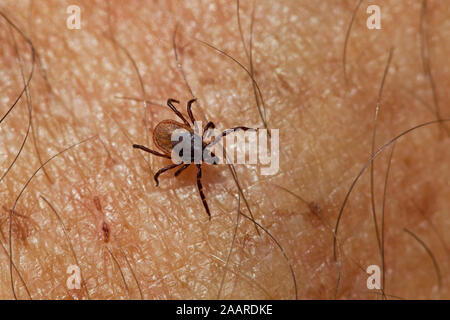 Gemeiner Holzbock (Ixodes ricinus) Zecke Stockfoto